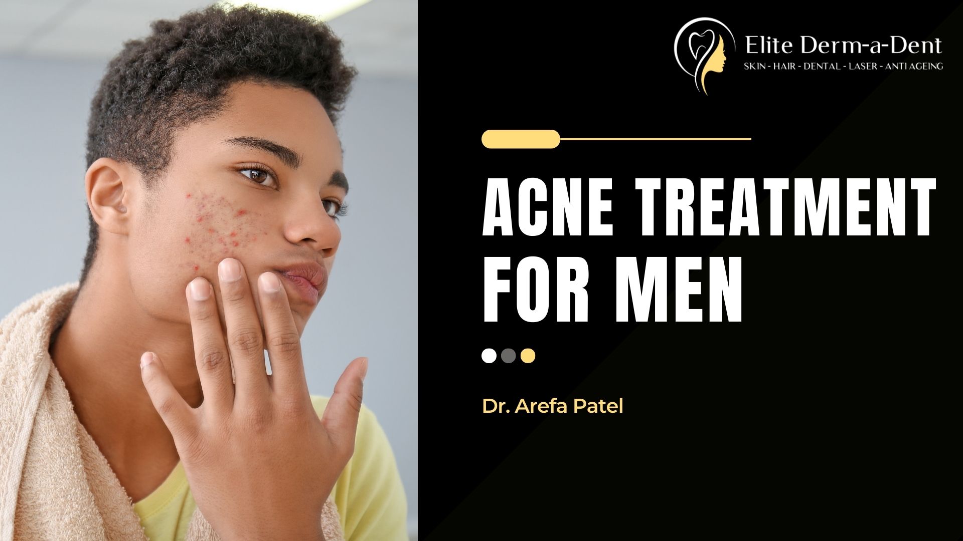 Acne Treatment for Men