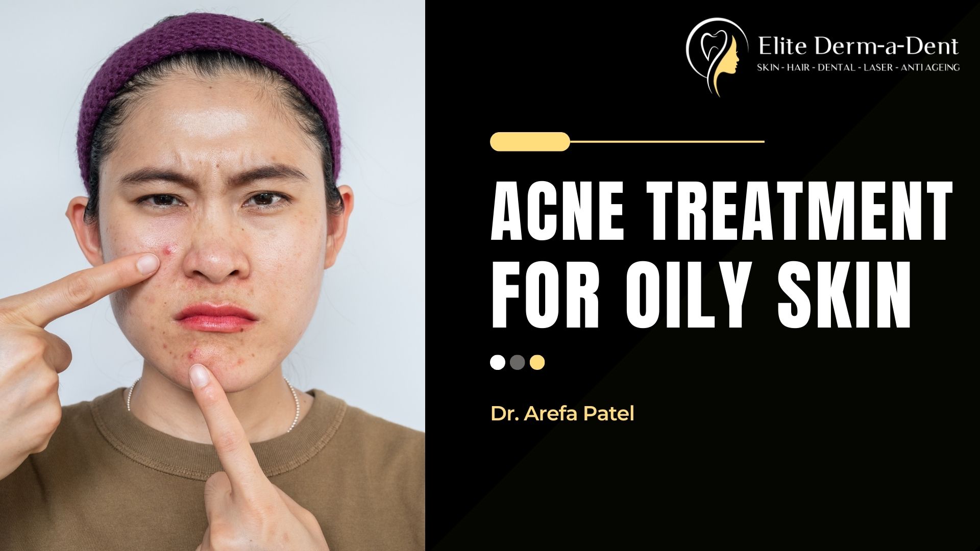 Acne Treatment for Oily Skin