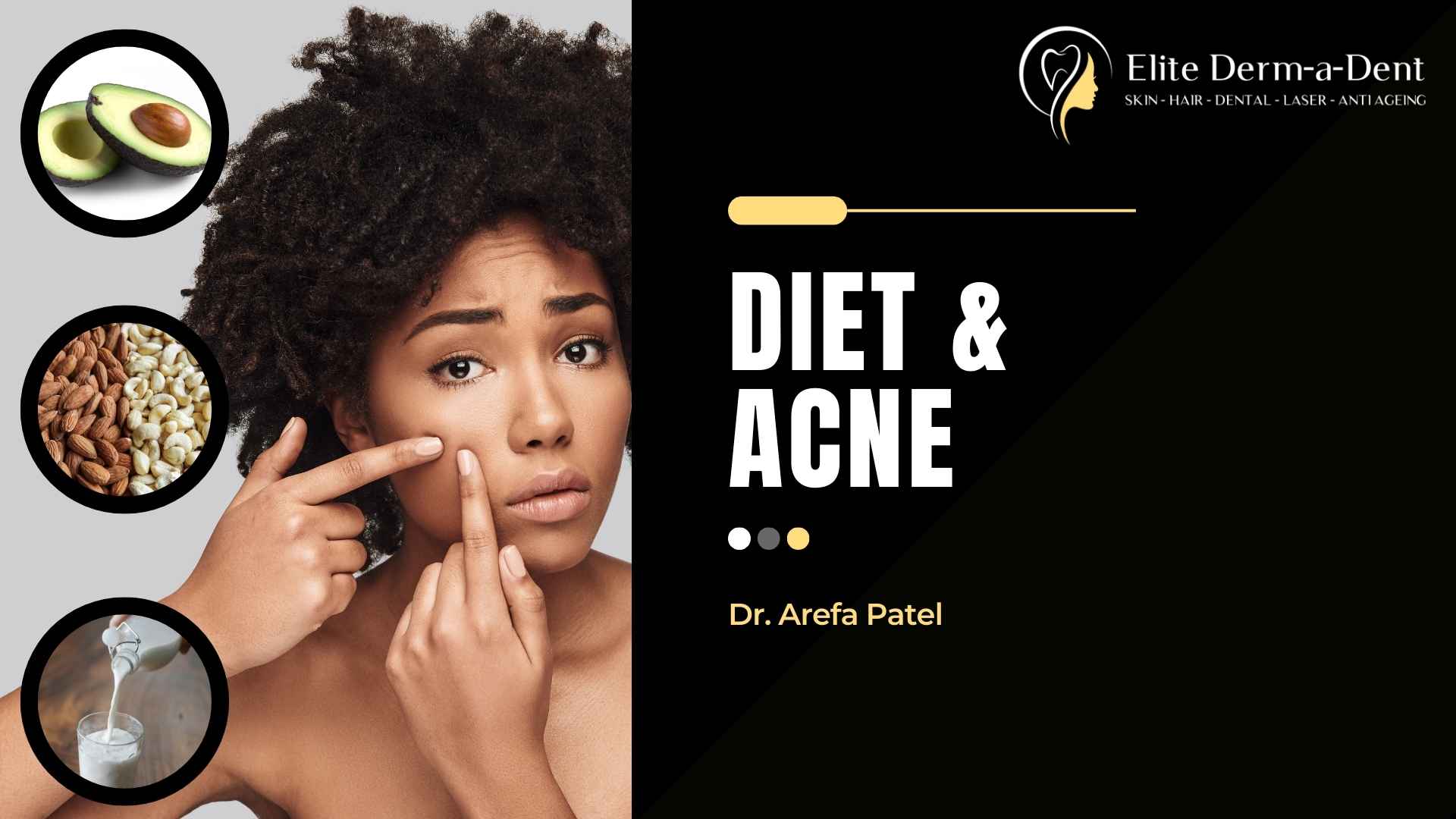 Diet and Acne by Dr Arefa Patel