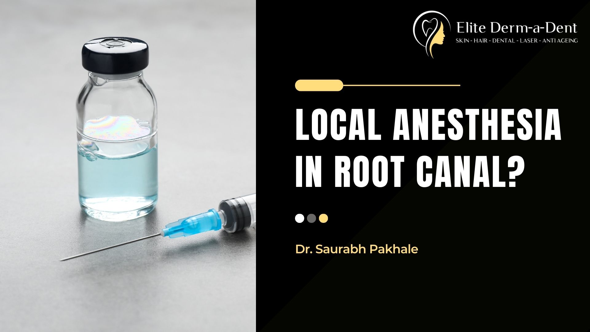 Local Anesthesia in Root Canals