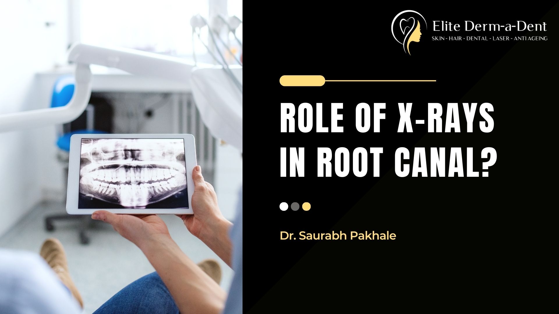 Role of Xrays in Root Canal