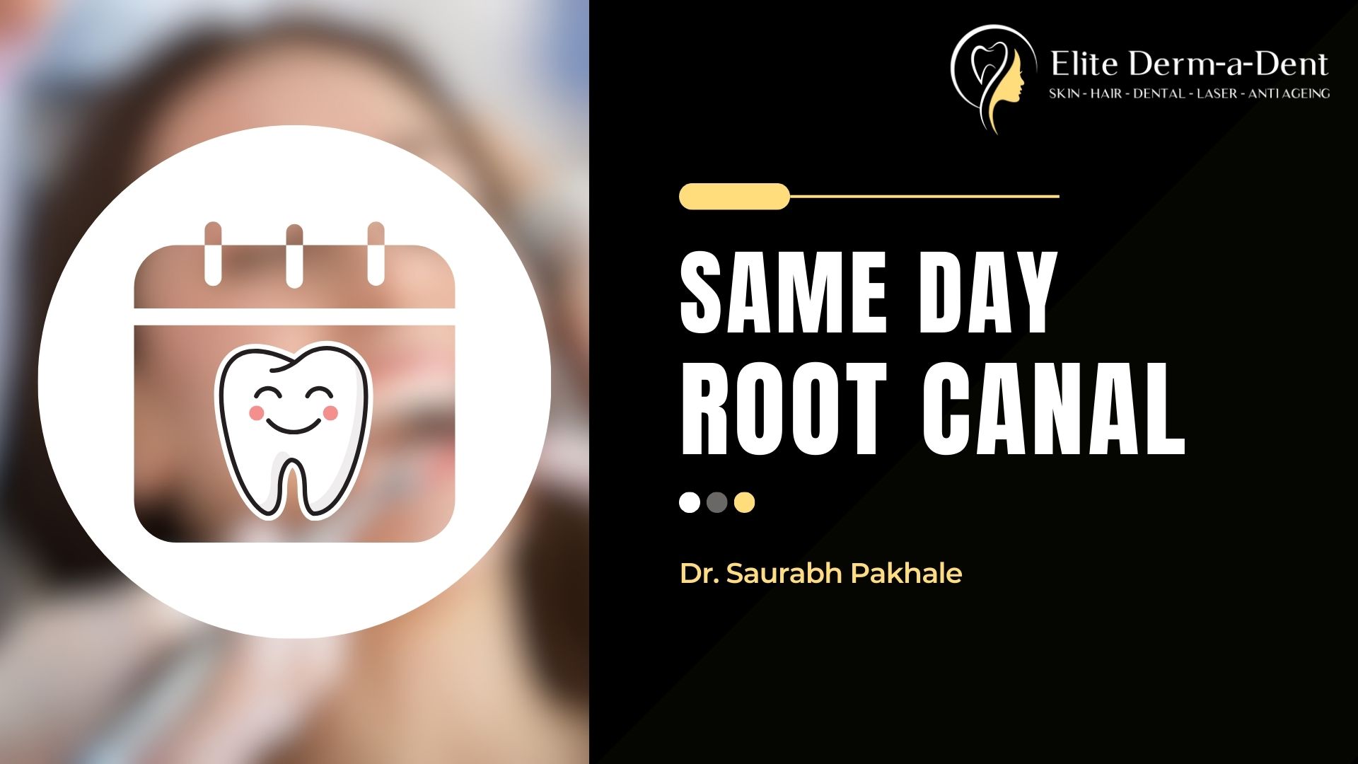 Same Day Root Canal in Thane