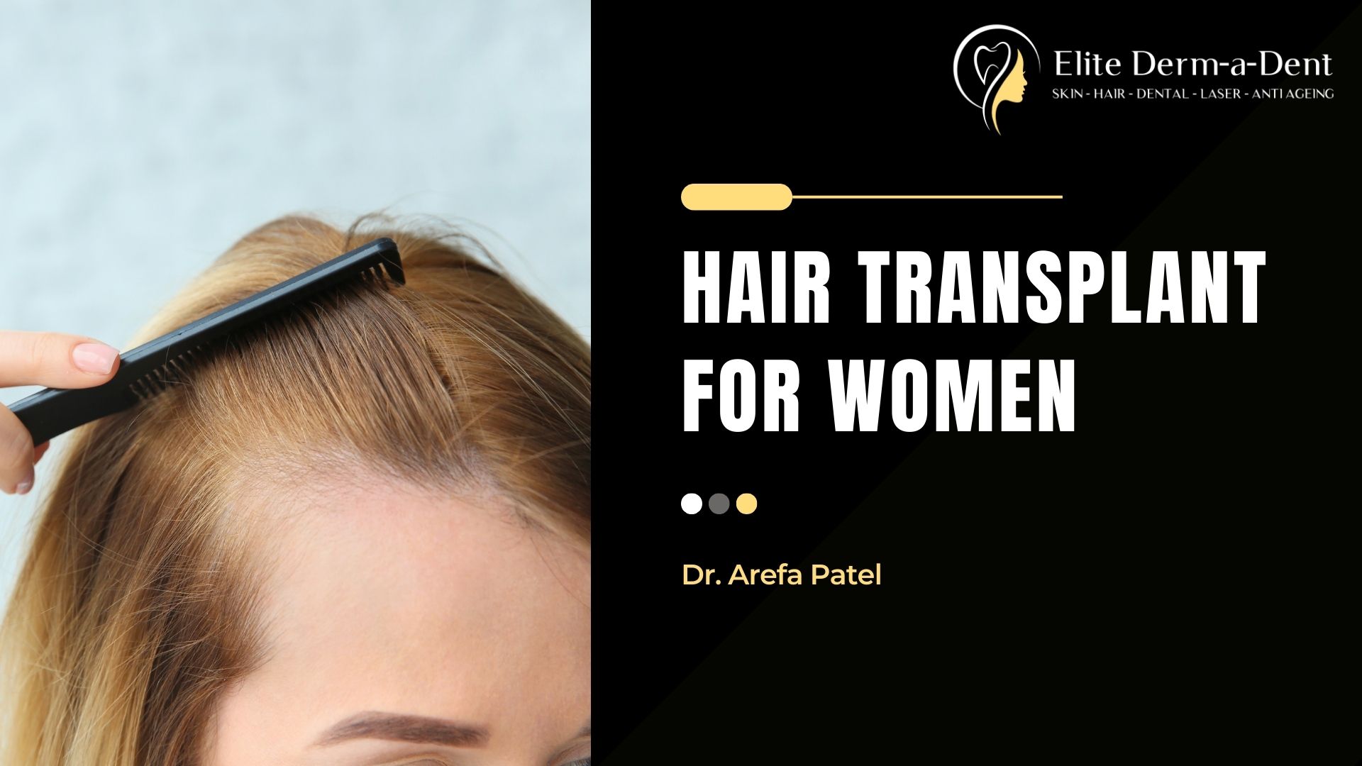 Hair Transplant For Women