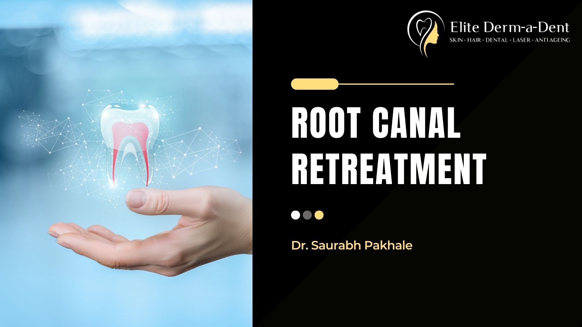 Root Canal Retreatment (2024): When and Why It's Necessary - Elite Derm ...