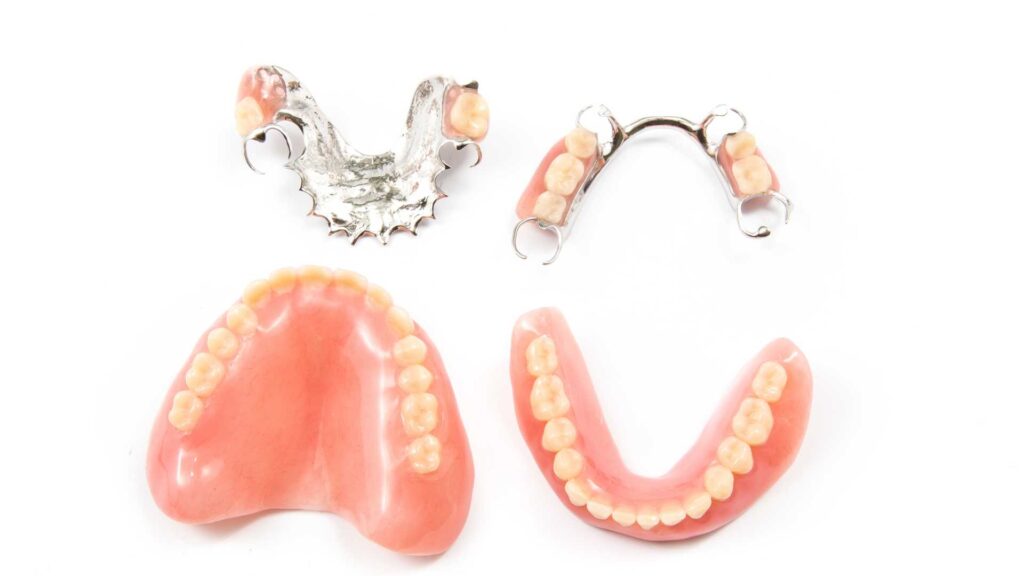 Types of Dentures