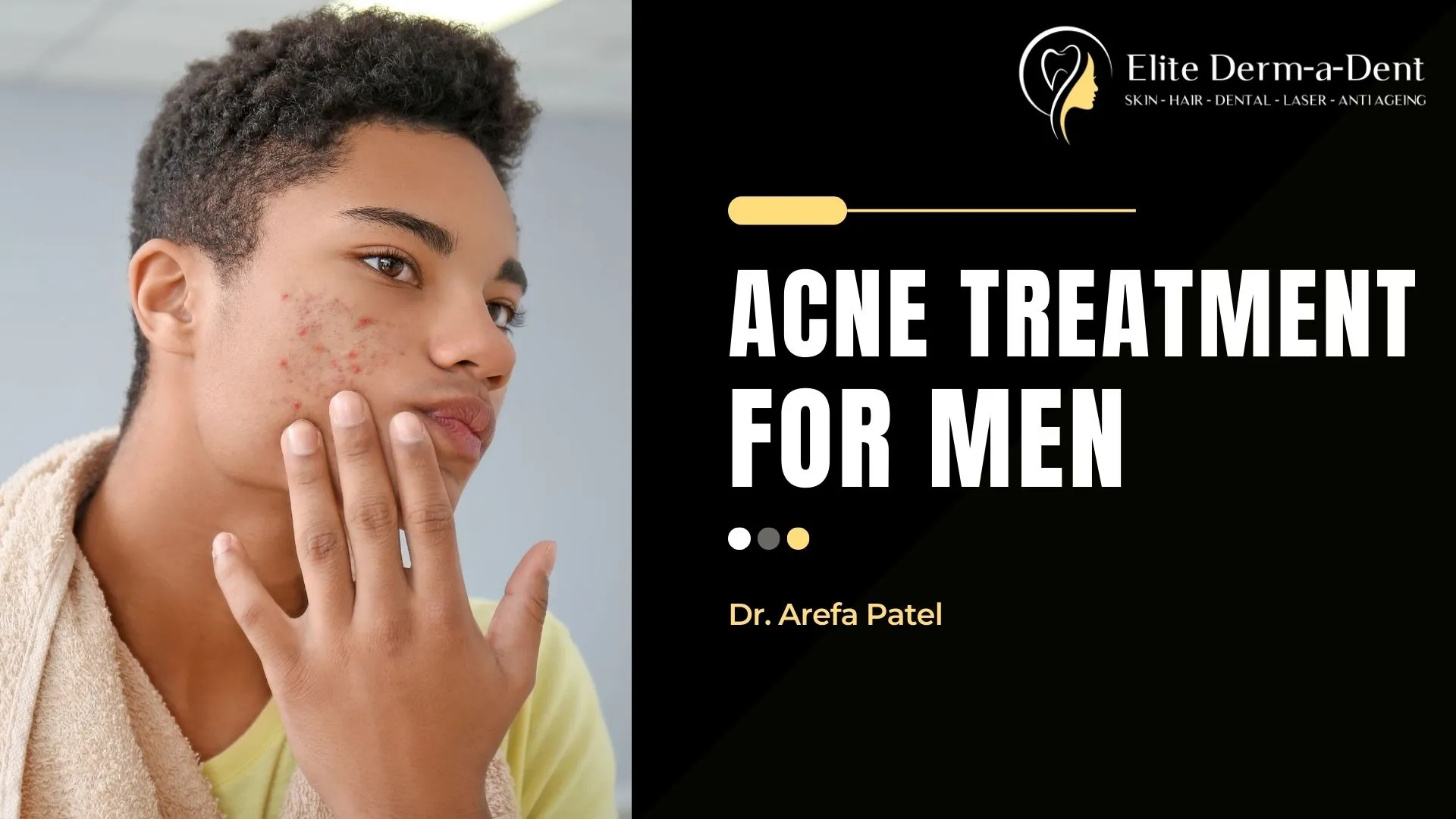 Acne-Treatment-for-Men