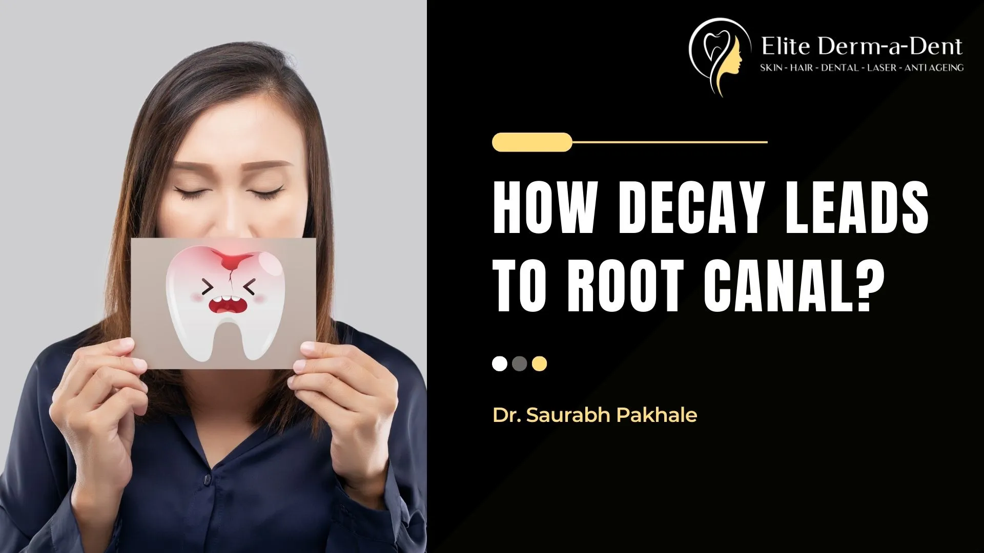 How Decay Leads to Root Canal (2025) | Dr Saurabh Pakhale