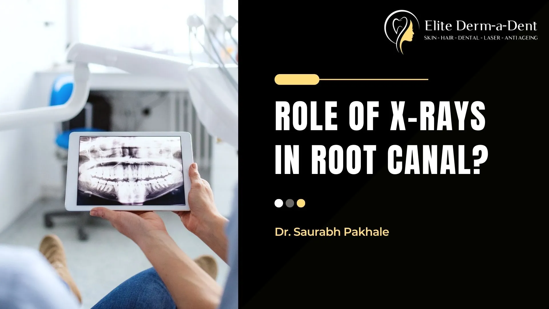 The Role of Dental X-Rays in Root Canals (2025) | Dr. Saurabh Pakhale