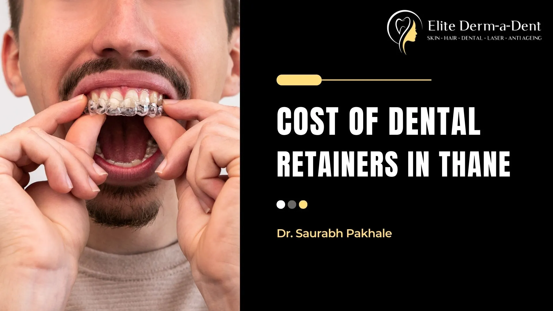 Comparison of Cost of Dental Retainers in Thane and Other Cities The cost of dental retainers varies significantly across Thane and neighboring cities, with prices influenced by factors such as type of retainer, clinic location, and additional services included. City Cost of Dental Retainers (INR) Notable Features Thane 5,000 – 10,000 Balanced pricing with many mid-range clinics available Mumbai 6,000 Higher pricing in South Mumbai; competitive rates in suburbs Navi Mumbai 5,000 Slightly lower prices than Thane with newer facilities Kalyan 4,500 More affordable options with fewer premium clinics Dombivli 4,000 Similar to Kalyan with competitive pricing Bhiwandi 3,500 Most affordable in the region with basic facilities Mira-Bhayandar 5,500 Growing number of clinics with competitive rates Ulhasnagar 3,000 Affordable options with fewer high-end clinics Panvel 4,000 Developing area with newer dental facilities Types of Dental Retainers Available Hawley Retainers These traditional retainers combine a plastic plate with wire and typically cost between ₹5,000 to ₹15,000, depending on customization and additional features. Clear Plastic Retainers These transparent retainers are more aesthetically pleasing and usually range from ₹1,500 to ₹5,00037. Fixed/Permanent Retainers These are bonded to the inner surface of teeth and can cost between ₹15,000 to ₹30,000, depending on the number of teeth involved. Factors Affecting Retainer Costs Type of retainer: Clear retainers are generally less expensive than custom-made ones3 Clinic location: Prices vary based on the city’s overall cost of living Dentist expertise: More experienced specialists may charge premium rates Additional services: Post-treatment follow-ups and adjustments may affect overall cost For exceptional dental care in Thane, Dr. Saurabh Pakhale at Elite Derm-a-Dent Clinic offers comprehensive retainer treatments with a patient-centric approach. With over 6 years of experience and specialized training, Dr. Pakhale provides high-quality dental services including retainer fittings in a comfortable, modern facility. Patients consistently praise his professional team, transparent pricing, and friendly environment. The clinic is conveniently located at Shop Number 16, K Wing Azziano, Rustomjee Urbania Township, near Saket Complex in Thane. Table of Contents Comparison of Cost of Dental Retainers in Thane and Other Cities Types of Dental Retainers Available Hawley Retainers Clear Plastic Retainers Fixed/Permanent Retainers Factors Affecting Retainer Costs Types of Dental Retainers Available in Thane Hawley Retainer Pricing Clear Plastic Retainer Expenses Fixed Retainer Installation Fees Factors Influencing Retainer Costs in Thane Dental Retention Specialists’ Expertise Clinic Location and Facilities Customization and Material Quality Post-Orthodontic Care Expenses Retainer Adjustment Fees Cleaning Solutions and Maintenance Products Affordable Retainer Options in Thane Budget-Friendly Alternatives Dental Retention Treatment Packages Payment Plans Available Maintaining Your Investment Proper Care for Extended Retainer Longevity When to Seek Retainer Replacement Cost-Saving Maintenance Tips Elite Derm-a-Dent Retainer Services Comprehensive Retainer Consultation Process Transparent Pricing Structure Comparing Retainer Costs Across Thane Price Ranges by Neighborhood Value Considerations Beyond Initial Cost Why Elite Derm-a-Dent Offers Competitive Pricing Frequently Asked Questions How long do different retainers last? Are payment plans available for retainer services? Does insurance cover retainer costs? What additional costs should I anticipate? How often should I replace my retainer? Conclusion Completing orthodontic treatment is a significant milestone, but maintaining that perfect smile requires ongoing care through dental retainers. These custom-fitted devices prevent teeth from shifting back to their original positions, preserving the results of your orthodontic treatment. In Thane, the cost of dental retainers varies considerably based on several factors, including type, material, and the dental clinic you choose. Understanding the financial aspects of retainer treatment helps patients make informed decisions about their oral health investments. Elite Derm-a-Dent, under the guidance of Dr. Saurabh Pakhale, offers comprehensive retainer services with transparent pricing to help patients navigate these choices effectively. Types of Dental Retainers Available in Thane Selecting the right retainer involves balancing cost, comfort, and effectiveness. Each type has distinct advantages and price points that cater to different needs and budgets. Hawley Retainer Pricing Hawley retainers remain one of the most traditional and widely used options in orthodontic retention. These devices feature a plastic base that fits against the roof of your mouth or behind your lower teeth, with a wire that wraps around the front teeth. Key features of Hawley retainers: Adjustable design allows for minor tooth movement if needed Durable construction with an average lifespan of 5-8 years with proper care Removable for easy cleaning and maintenance Available in various colors and designs for personalization In Thane, Hawley retainers typically cost between ₹5,000 and ₹15,000, depending on customization options and the dental clinic’s pricing structure. While they represent a higher initial investment than some alternatives, their durability often makes them cost-effective over time. Factors affecting Hawley retainer pricing: Quality of acrylic used in the base plate Type of wire material (standard vs. premium) Customization options (colors, designs, etc.) Reputation and location of the dental practice Clear Plastic Retainer Expenses Clear plastic retainers have gained popularity due to their discreet appearance and comfortable fit. These transparent devices are custom-molded to fit precisely over your teeth. Types of clear retainers available in Thane: Vacuum-formed retainers: Thinner and less durable, typically priced between ₹1,500 and ₹3,000 Pressure-formed retainers: More durable with better fit, usually costing ₹3,000 to ₹5,000 Premium clear retainers: Made with advanced materials for enhanced durability, ranging from ₹5,000 to ₹8,000 Clear retainers generally need replacement more frequently than Hawley retainers, usually every 1-3 years depending on wear patterns and care. This replacement frequency should be factored into long-term cost considerations. Clear Retainer Type Price Range (₹) Average Lifespan Best For Vacuum-formed 1,500 – 3,000 6-12 months Short-term use, budget-conscious patients Pressure-formed 3,000 – 5,000 1-2 years Standard retention needs Premium clear 5,000 – 8,000 2-3 years Patients seeking durability and comfort Fixed Retainer Installation Fees Fixed (permanent) retainers consist of a thin wire bonded to the inner surface of the front teeth. They provide continuous retention without requiring patient compliance for wearing removable devices. Cost considerations for fixed retainers: Initial installation: ₹15,000 to ₹30,000 depending on the number of teeth involved Material quality: Stainless steel vs. gold-plated or specialized alloys Bonding technique and materials used Expertise of the orthodontist performing the procedure While fixed retainers have a higher upfront cost, they eliminate the risk of loss or damage associated with removable options. However, they do require special cleaning techniques and occasional maintenance visits if the wire becomes loose or damaged. Benefits of permanent retainer bonding: 24/7 retention without relying on patient compliance Invisible from the outside No speech impediments or adaptation period Effective for patients with high risk of relapse Factors Influencing Retainer Costs in Thane Understanding what drives the cost of retainers helps patients evaluate pricing and determine if they’re receiving good value. Several key factors influence retainer pricing in Thane: Dental Retention Specialists’ Expertise The qualifications and experience of the dental professional significantly impact retainer costs. Specialists with advanced training in orthodontics or those with extensive experience may charge premium rates, but often deliver superior results. Expertise considerations: General dentists typically charge less than orthodontic specialists Practitioners with advanced certifications in specific retainer technologies may command higher fees Clinics with orthodontic residents or newer practitioners sometimes offer reduced rates Elite Derm-a-Dent’s team combines specialized training with reasonable pricing structures Clinic Location and Facilities The location of a dental practice within Thane affects overhead costs, which in turn influences retainer pricing. Additionally, clinics with advanced technology and premium facilities typically charge more for their services. Location factors in Thane: Central Thane locations generally have higher prices than peripheral areas Clinics in upscale neighborhoods or commercial complexes typically charge premium rates Facilities with digital scanning technology (instead of traditional impressions) may have higher fees Practices with in-house laboratories can sometimes offer more competitive pricing Customization and Material Quality The degree of customization and quality of materials used significantly impact retainer costs. Higher-quality materials offer better durability, comfort, and aesthetics but come at a premium price. Material considerations: Medical-grade vs. standard acrylics for Hawley retainers Thickness and clarity of plastic in clear retainers Specialized wire compositions in fixed retainers Hypoallergenic options for sensitive patients Post-Orthodontic Care Expenses The initial cost of a retainer is just one component of the overall expense. Patients should also consider ongoing maintenance and potential additional services. Retainer Adjustment Fees Occasional adjustments may be necessary to maintain proper fit and function of retainers. These adjustments typically cost between ₹500 and ₹2,000 depending on the complexity and type of retainer. Common adjustment services: Wire tightening or reshaping for Hawley retainers Edge smoothing for clear retainers Rebonding loose sections of fixed retainers Addressing pressure points or discomfort Cleaning Solutions and Maintenance Products Proper retainer care requires specific cleaning products and accessories, adding to the overall cost of retainer ownership. Essential maintenance products: Specialized retainer cleaning tablets: ₹300-₹800 per month Ultrasonic cleaners: One-time purchase of ₹1,500-₹5,000 Storage cases: ₹200-₹500 each Specialized brushes for fixed retainers: ₹100-₹300 Affordable Retainer Options in Thane While dental retainers represent an investment in your long-term oral health, several strategies can help make them more affordable without compromising quality. Budget-Friendly Alternatives Not all retainer solutions need to strain your finances. Several cost-effective options exist for patients with budget constraints: Economical retainer options: Seasonal promotions: Many Thane clinics offer special pricing during certain times of the year Student discounts: Some practices provide reduced rates for students Package deals: Combining retainer costs with final orthodontic treatments can result in overall savings Basic models: Opting for standard designs without cosmetic enhancements reduces costs Dental Retention Treatment Packages Comprehensive packages often provide better value than à la carte services. At Elite Derm-a-Dent, retention packages typically include: Initial retainer fitting Follow-up adjustments (typically 2-3 visits) Emergency appointments for unexpected issues Basic cleaning supplies Replacement guarantee for manufacturing defects These packages generally range from ₹8,000 to ₹20,000 depending on the retainer type and included services, representing savings of 15-25% compared to individual service pricing. Payment Plans Available Many dental practices in Thane recognize that retainer costs can be significant and offer flexible payment options: Common payment arrangements: Interest-free installment plans (typically 3-6 months) Dental savings plans with discounted rates Credit card payment options with extended terms Family discounts for multiple patients Elite Derm-a-Dent offers customized payment solutions to ensure that financial constraints don’t prevent patients from maintaining their orthodontic results. Maintaining Your Investment Proper care extends the lifespan of retainers, maximizing the value of your investment and potentially reducing long-term costs. Proper Care for Extended Retainer Longevity Following recommended care protocols significantly impacts retainer durability: Essential care practices: Clean removable retainers daily using appropriate methods Store retainers in protective cases when not in use Avoid exposure to heat (hot water, direct sunlight, dashboards) Remove retainers when eating (for removable types) Schedule regular professional cleaning When to Seek Retainer Replacement Even with excellent care, retainers eventually require replacement. Recognizing the signs helps prevent orthodontic relapse: Indicators for replacement: Visible cracks or breaks Loose fit or gaps between retainer and teeth Significant discoloration or calcification Persistent unpleasant odor despite proper cleaning Discomfort or irritation not resolved by adjustments Most clear retainers need replacement every 1-3 years, while Hawley retainers typically last 5-8 years. Fixed retainers can remain effective for 10+ years if properly maintained. Cost-Saving Maintenance Tips Strategic maintenance practices can extend retainer life and reduce replacement frequency: Money-saving maintenance strategies: Use retainer cases rather than tissues or napkins to prevent loss Remove retainers before consuming colored foods or beverages Avoid using toothpaste on clear retainers (causes microscopic scratches) Schedule bi-annual dental check-ups to address minor issues before they require costly repairs Consider professional ultrasonic cleaning twice yearly Elite Derm-a-Dent Retainer Services Elite Derm-a-Dent offers comprehensive retainer services designed to provide excellent value while maintaining the highest standards of care. Comprehensive Retainer Consultation Process The practice follows a thorough assessment protocol to determine the most appropriate and cost-effective retention solution: Consultation components: Detailed examination of current tooth positioning Review of orthodontic history and relapse risk Discussion of lifestyle factors affecting retainer selection Transparent cost breakdown and payment options Digital scanning for precise retainer fabrication Transparent Pricing Structure Elite Derm-a-Dent maintains clear, upfront pricing to eliminate surprises: Service Price Range (₹) What’s Included Basic Hawley Retainer 5,000 – 7,000 Standard design, two adjustments Premium Hawley Retainer 7,000 – 15,000 Custom design, premium materials, unlimited adjustments for 1 year Standard Clear Retainer 3,000 – 5,000 Basic clear retainer, one adjustment Premium Clear Retainer 5,000 – 8,000 Enhanced durability, three adjustments, replacement guarantee Fixed Retainer 15,000 – 30,000 Installation, follow-up visit, emergency care for 6 months Comprehensive Package 20,000 – 35,000 Both removable and fixed options, all adjustments, cleaning kit Comparing Retainer Costs Across Thane Retainer pricing varies significantly throughout Thane, with several factors influencing regional differences. Price Ranges by Neighborhood Location significantly impacts pricing within Thane: Neighborhood price variations: Central Thane: Premium pricing (typically 10-15% above average) Ghodbunder Road area: Moderate pricing with newer facilities Eastern suburbs: Generally more affordable options Western Thane: Mid-range pricing with good value Value Considerations Beyond Initial Cost When evaluating retainer costs, patients should consider several factors beyond the initial price: Value indicators: Warranty period and coverage terms Included follow-up visits Emergency appointment availability Quality of materials used Practitioner experience and qualifications Clinic reputation and patient reviews Why Elite Derm-a-Dent Offers Competitive Pricing Elite Derm-a-Dent maintains reasonable pricing while delivering premium care through: Efficient clinical processes that maximize practitioner time Strategic supplier relationships for quality materials at better prices Digital technology that reduces material waste and improves precision Focus on preventive care to minimize costly complications Volume-based practice model that distributes overhead costs effectively Frequently Asked Questions How long do different retainers last? Retainer longevity varies by type and care: Clear plastic retainers: 1-3 years with proper care Hawley retainers: 5-8 years on average Fixed retainers: 10+ years if properly bonded and maintained Are payment plans available for retainer services? Most reputable clinics in Thane, including Elite Derm-a-Dent, offer flexible payment options. These typically include: Interest-free installment plans Credit card payment options Family package discounts Seasonal promotions Does insurance cover retainer costs? Dental insurance coverage for retainers varies significantly: Basic dental plans typically don’t cover retainers Premium orthodontic coverage may provide partial reimbursement Health savings accounts (HSAs) can often be used for retainer expenses Some employer dental plans include orthodontic retention benefits What additional costs should I anticipate? Beyond the initial retainer cost, patients should budget for: Replacement costs (particularly for clear retainers) Adjustment fees if not included in the original package Cleaning supplies and storage cases Emergency repairs for damage or loss Professional cleaning services How often should I replace my retainer? Replacement frequency depends on several factors: Clear retainers: Every 1-3 years Hawley retainers: Every 5-8 years Fixed retainers: Only when damaged or debonded Replacement may be needed sooner with improper care or grinding/clenching habits Conclusion Investing in quality dental retainers represents a crucial step in preserving orthodontic results and maintaining oral health. While costs vary across Thane, understanding the factors influencing pricing helps patients make informed decisions that balance budget constraints with treatment effectiveness. Elite Derm-a-Dent offers comprehensive retainer solutions with transparent pricing, flexible payment options, and expert care under Dr. Saurabh Pakhale’s guidance. By focusing on quality materials, precise customization, and excellent follow-up care, the practice delivers exceptional value for patients seeking reliable retention solutions. To explore retainer options and receive a personalized cost assessment, schedule a consultation with Elite Derm-a-Dent’s experienced team. Your smile investment deserves the protection of properly fitted, high-quality retainers that provide lasting results without unnecessary financial burden.