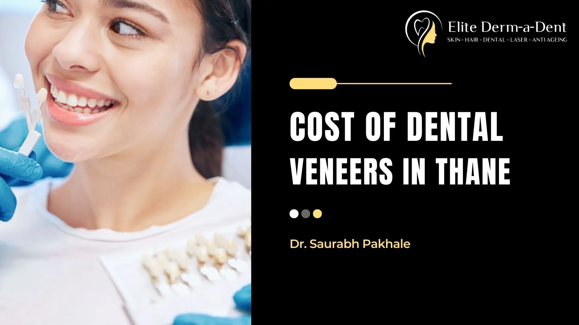 Cost of Dental Veneers in Thane