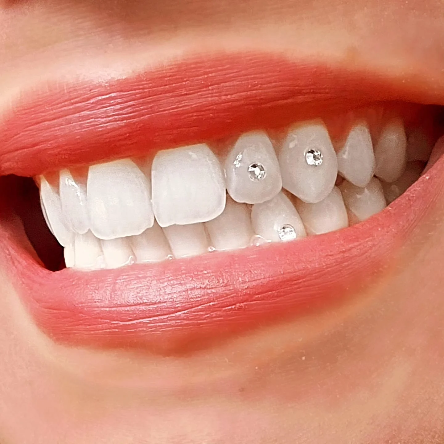 Cost of Tooth Jewelry in Thane