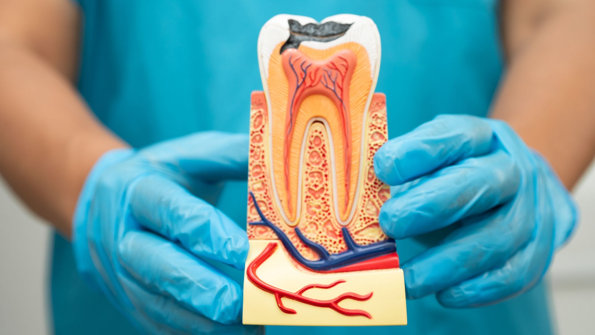 Can a Root Canal Tooth Get Infected?