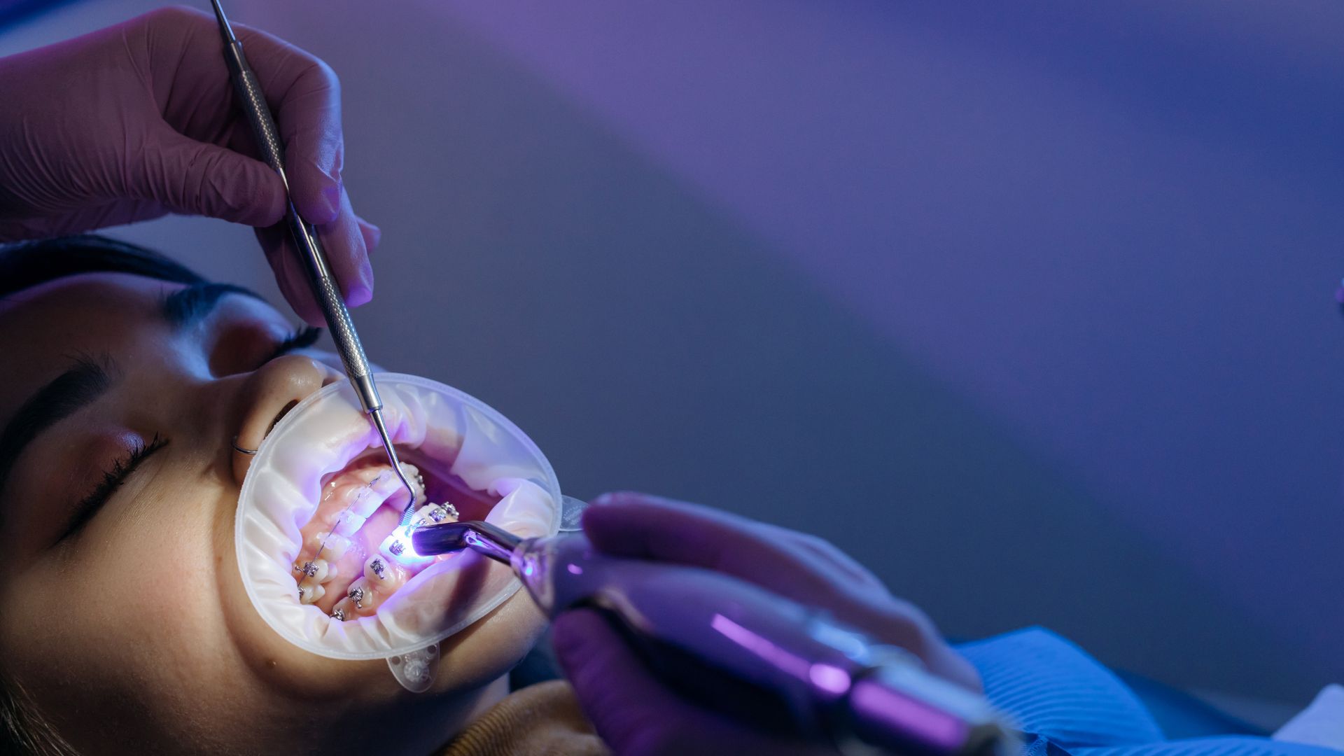 How Many Root Canals Are in a Tooth? Anatomy & Retreatment Guide (2026)