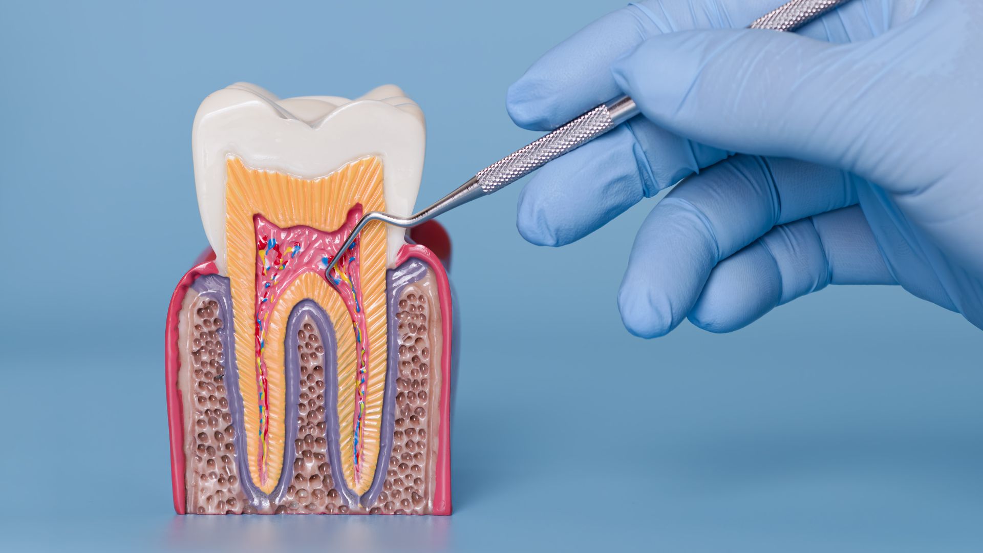 Will a Root Canal Tooth Fall Out