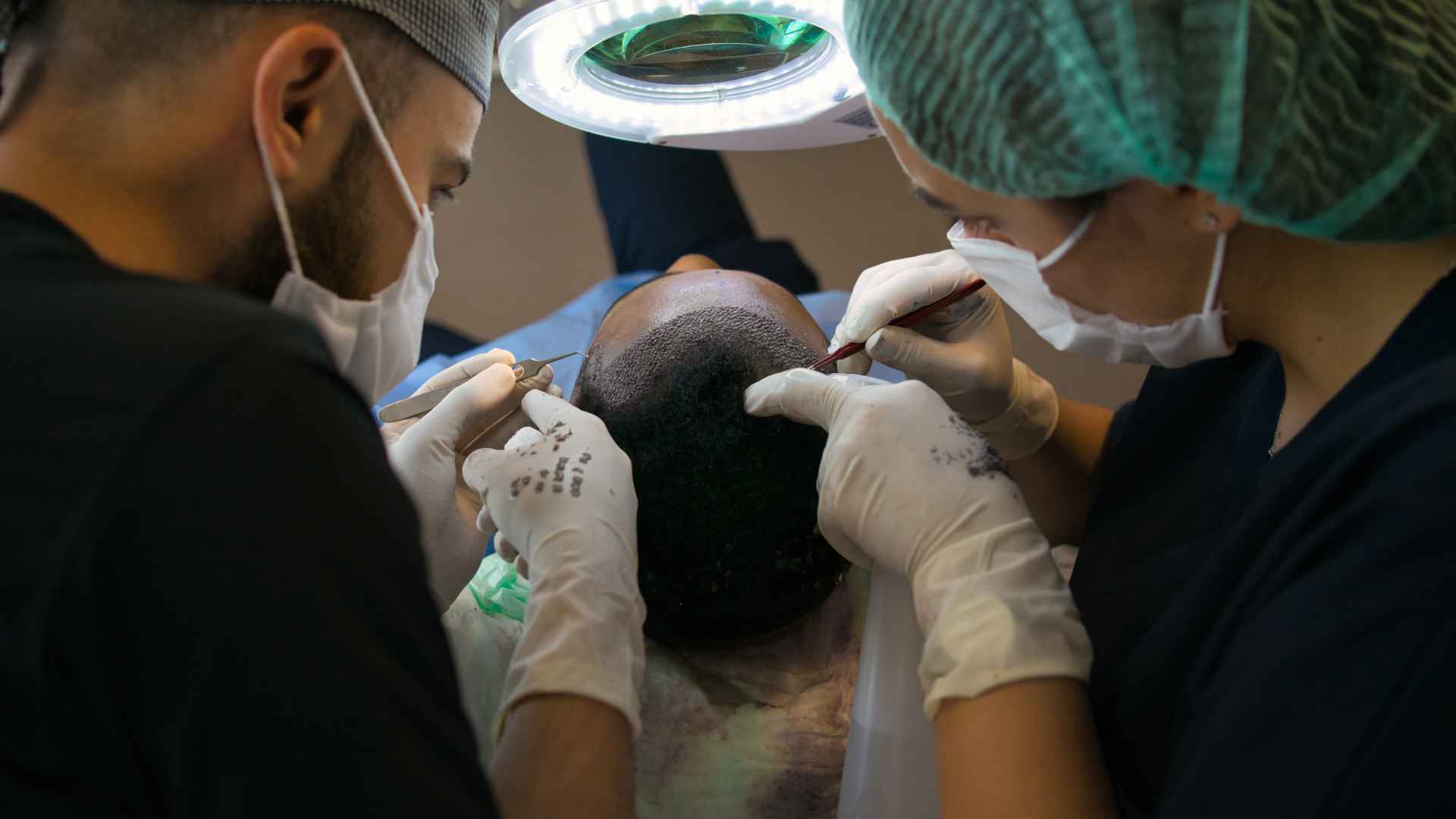 Who Does Hair Transplants? A Guide to Choosing the Right Specialist