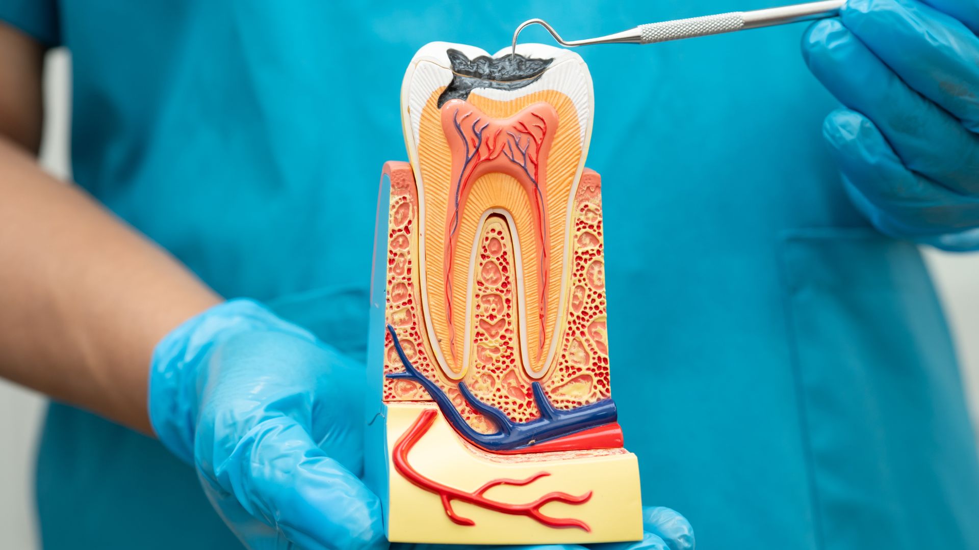 When a Root Canal Cannot Be Done